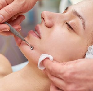LIMPIEZA FACIAL PROFUNDA 21